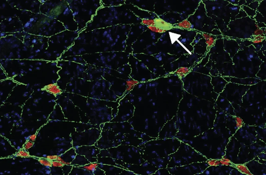 Uncovering The Unexpected Causes Of Parkinson's Disease