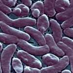 Vibrio Vulnificus: Rare Man Eating Bacteria Kills 3 In Connecticut And