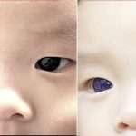 Baby Boy's Dark Brown Eyes Turn Bright Blue Overnight After