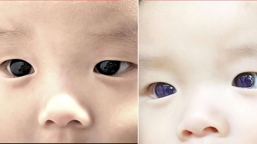 Baby Boy's Dark Brown Eyes Turn Bright Blue Overnight After