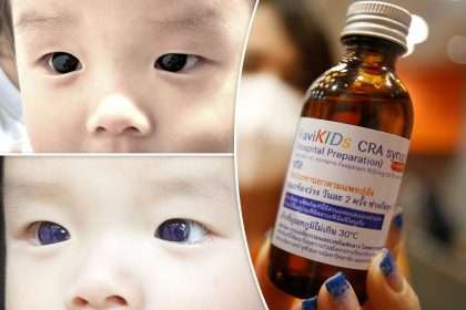 Baby's Brown Eyes Turn Blue Overnight After Covid 19 Treatment
