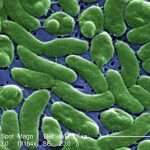 Cdc Warns Medical Professionals About Vibrio Vulnificus Bacteria