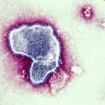 Cdc Warns That Respiratory Syncytial Virus Is On The Rise