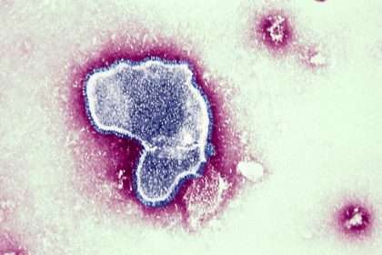 Cdc Warns That Respiratory Syncytial Virus Is On The Rise