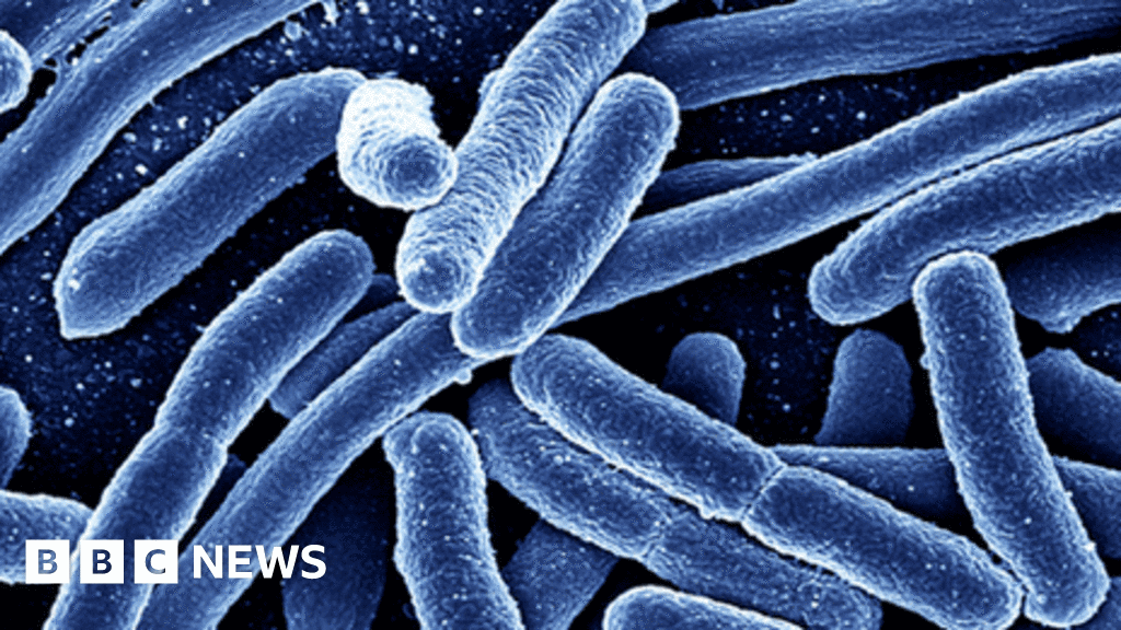 Canadian Authorities Investigate E. Coli Outbreak At Calgary Daycare Center
