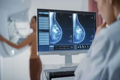 Doctor Explains Why Breast Density Requires Additional Screening