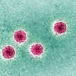 New Jersey Restaurant Worker Tests Positive For Hepatitis A, Prompting