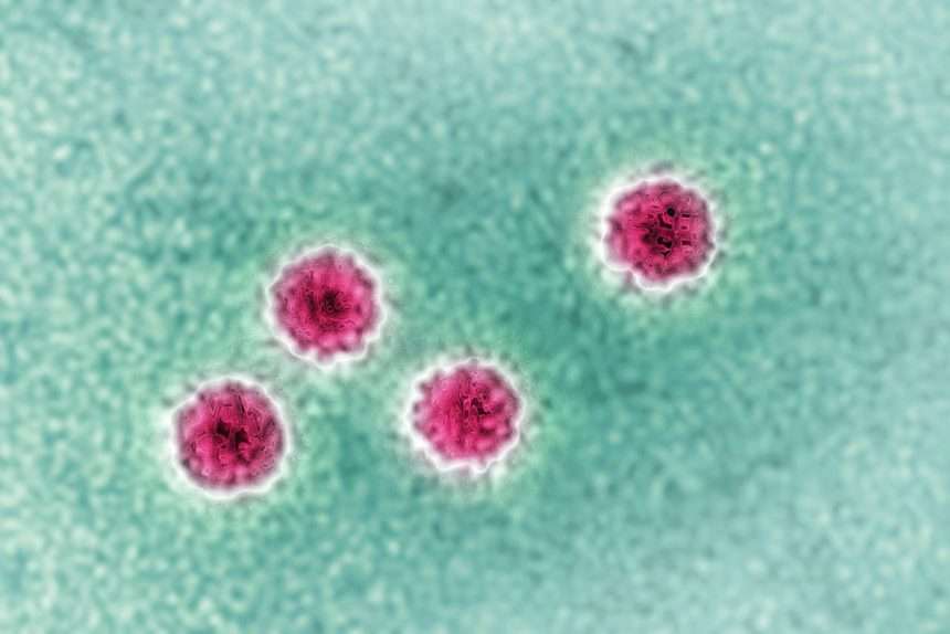 New Jersey Restaurant Worker Tests Positive For Hepatitis A, Prompting