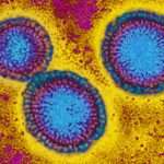 Who Says Influenza Vaccines Should Eliminate Strains Wiped Out By
