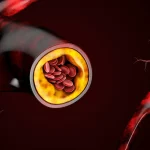 New Cholesterol Drug Could Harm Lungs, Landmark Global Study Warns