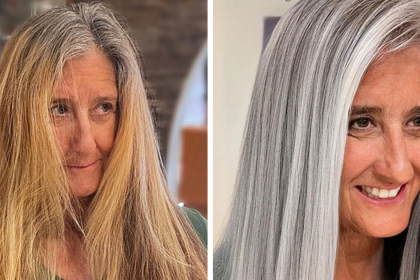 20 People Before And After Embracing Their Natural Gray Hair