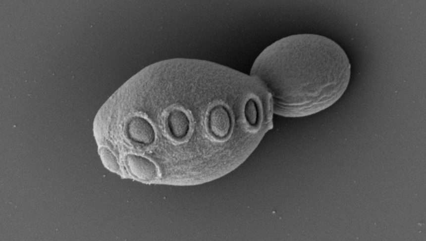 Revolution In Biology: Semisynthetic Yeast Genome Reveals New Horizons In