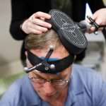 Using Tms Magnetic Therapy Reduced Symptoms Of Depression Within A
