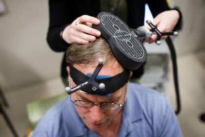 Using Tms Magnetic Therapy Reduced Symptoms Of Depression Within A