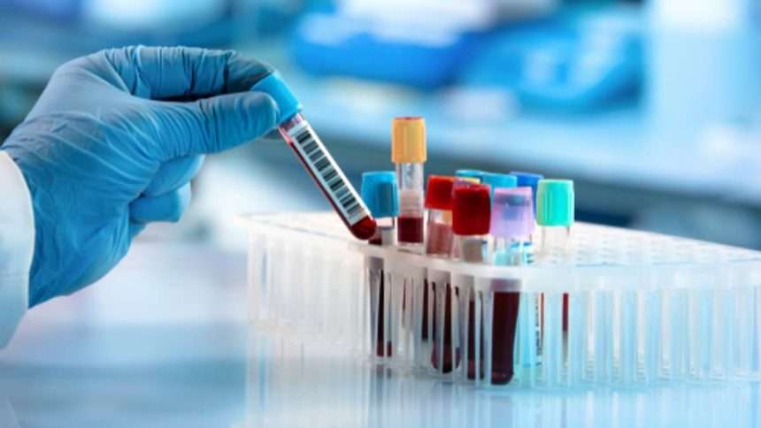 A Breakthrough In Sepsis Treatment As New Blood Test Quickly