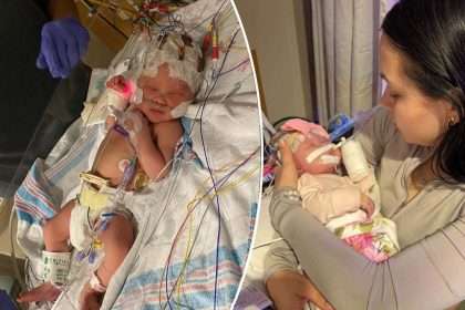 Baby Born Blind With Half Brain Removed Is Doing Well