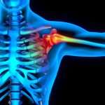 Common Shoulder Treatments Found To Be Ineffective