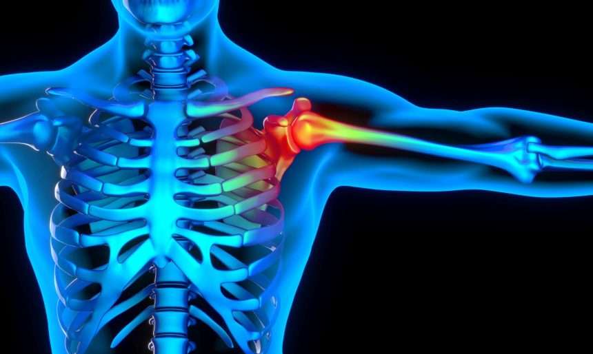 Common Shoulder Treatments Found To Be Ineffective