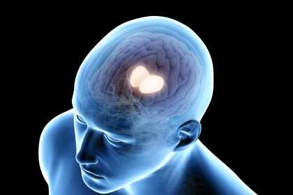 Deep Brain Stimulation Targeting The Thalamus Improves Cognition In Brain Injured