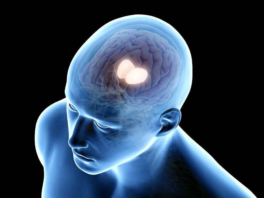 Deep Brain Stimulation Targeting The Thalamus Improves Cognition In Brain Injured