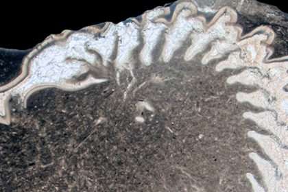 Ever Wanted To Curl Into A Ball? Fossils Show How