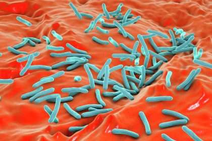 University Of California, Davis Announces Confirmed Case Of Infectious Tuberculosis