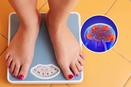 Weight Loss Through Intermittent Fasting May Change Brain Activity