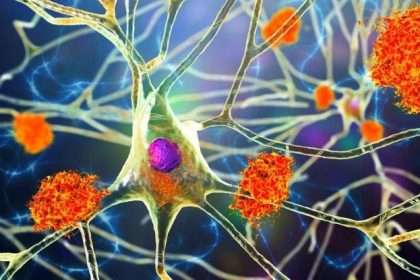 Groundbreaking Alzheimer's Disease Discovery Reveals Five Distinct Variants: Sciencealert