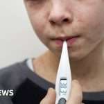 Measles: Why Are Infections Increasing And What Are The Symptoms?