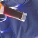 Scientists Find Blood Type Affects Early Stroke Risk: Sciencealert