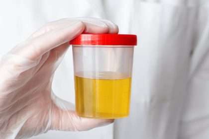 Scientists Have Discovered Why Pee Is Yellow, So You Can