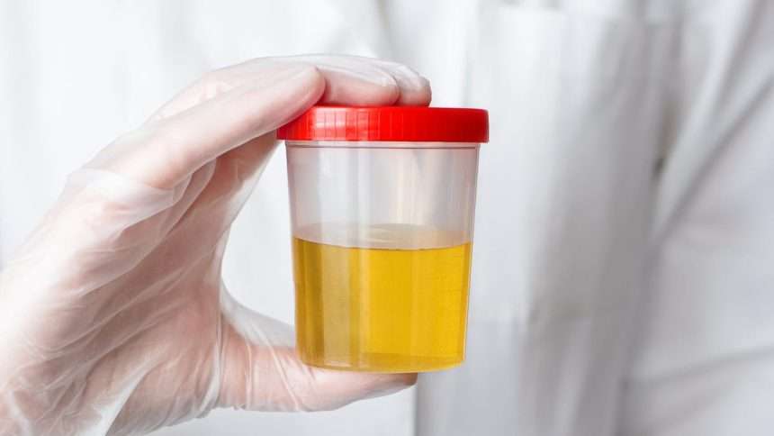 Scientists Have Discovered Why Pee Is Yellow, So You Can