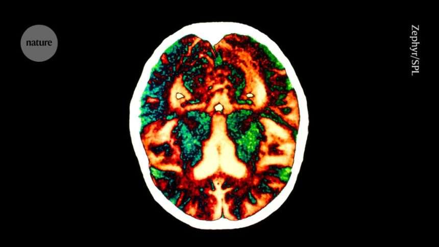 Signs Of 'contagious' Alzheimer's Disease Seen In People Treated With