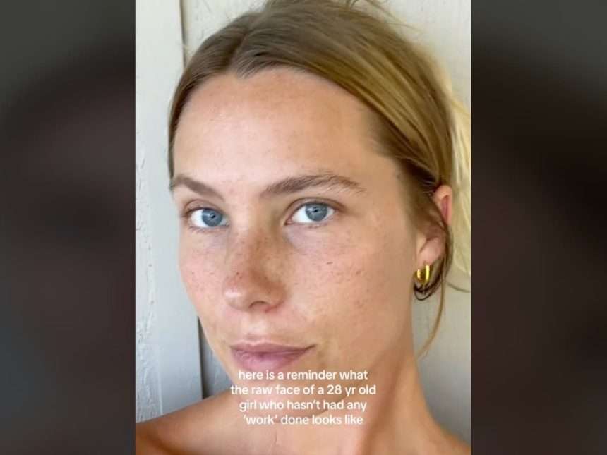 The 28 Year Old Mother Posted Her ``real Face'' To Normalize Aging,