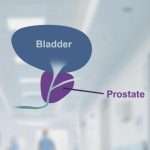 What Is The Prostate And Why Does It Cause So