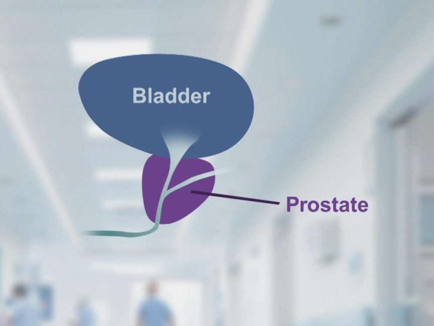 What Is The Prostate And Why Does It Cause So