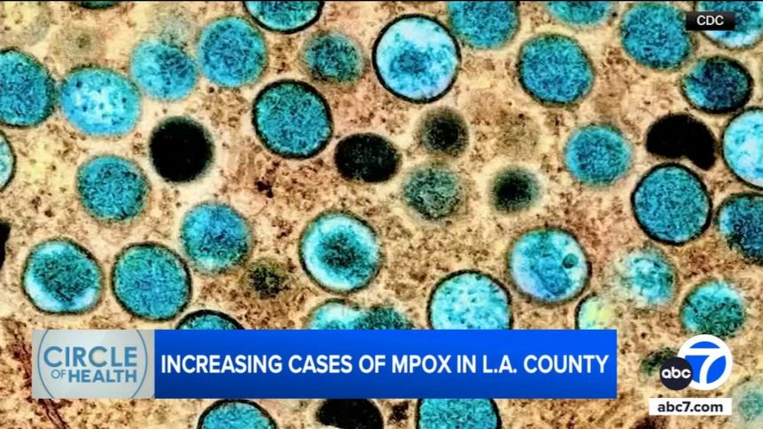 Chickenpox Cases On The Rise In Los Angeles County; Health