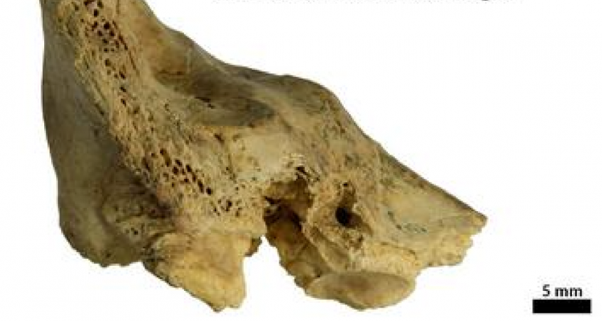 First Fossil Evidence Of Down Syndrome In Neanderthals Shows Compassionate