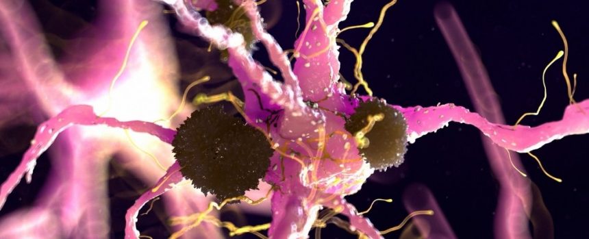 Parkinson's Disease Discovery Suggests Fda Approved Treatment May Already Exist: Sciencealert