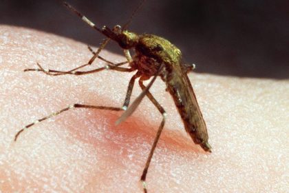 What To Put On Mosquito Bites? How To Cure Itching