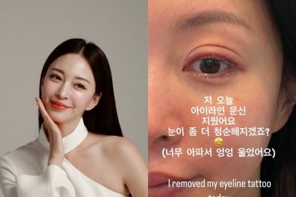 Actress Han Ye Seul Reveals Removal Of Eyeliner Tattoo